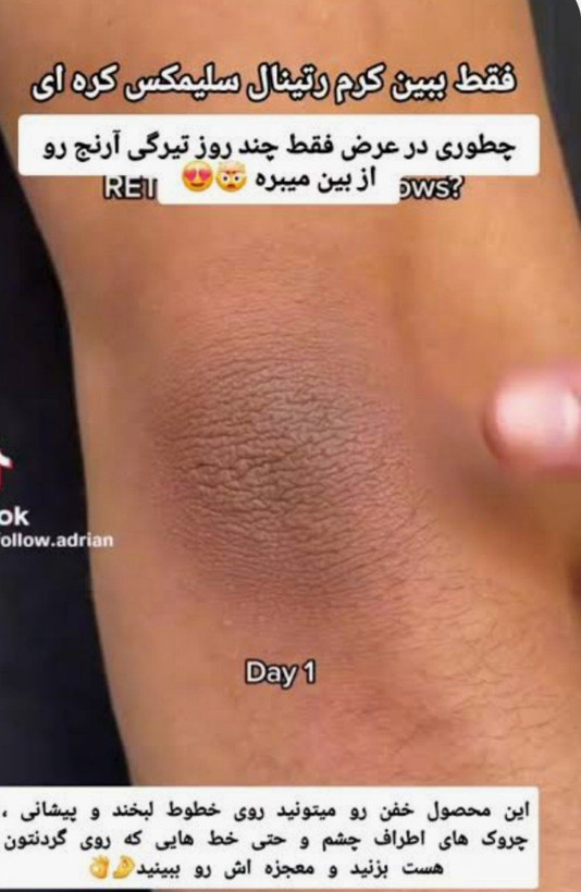 مناسب پوستهای مستعد پیری، کدر و افتاده